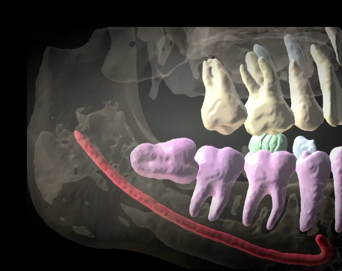 Cada dente separado, com raiz e número