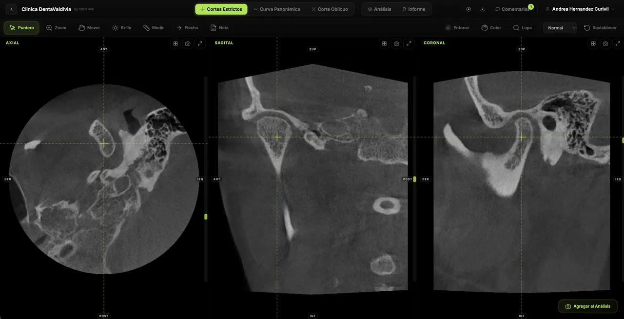 CBCTHub Visor DICOM online